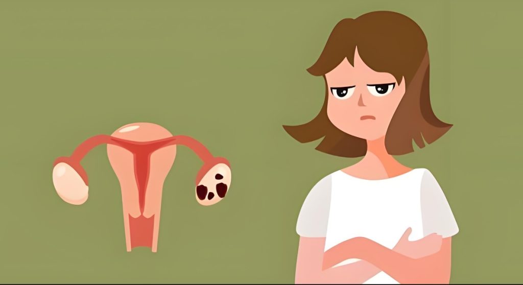 How to maintain your uterus