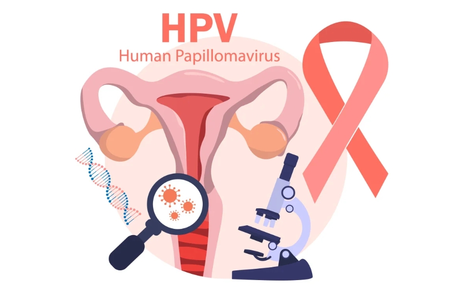 Whether women self-test for HPV infection