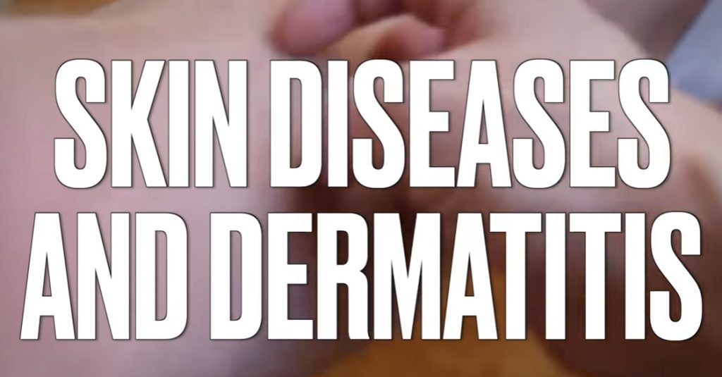 Understanding Skin Diseases and Dermatitis: The Vitamin D Connection